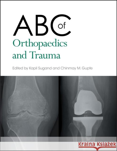 ABC of Orthopaedics and Trauma K Sugand 9781118561225 Wiley-Blackwell