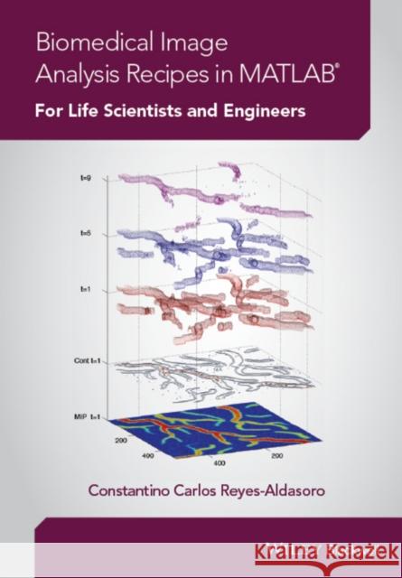 Biomedical Image Analysis Recipes in MATLAB: For Life Scientists and Engineers Reyes–Aldasoro, Carlos; Bhalerao, Abhir 9781118657553 John Wiley & Sons