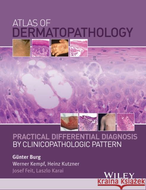 Atlas of Dermatopathology: Practical Differential Diagnosis by Clinicopathologic Pattern Burg, Günter 9781118658314
