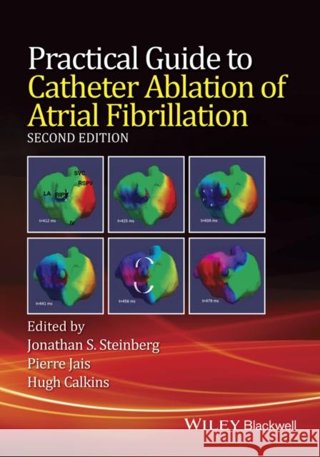 Practical Guide to Catheter Ablation of Atrial Fibrillation Steinberg, Jonathan; Jais, Pierre; Calkins, Hugh 9781118658505