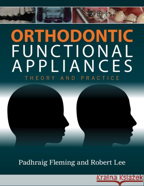 Orthodontic Functional Appliances : Theory and Practice Padhraig S. Fleming 9781118670576 Wiley-Blackwell