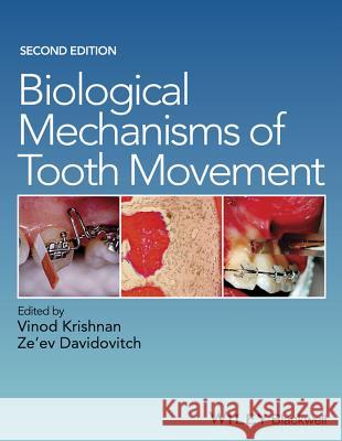 Biological Mechanisms of Tooth Movement  9781118688878 John Wiley & Sons