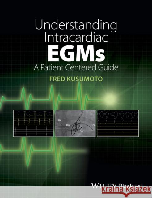 Understanding Intracardiac Egms: A Patient Centered Guide Kusumoto, Fred M. 9781118721360