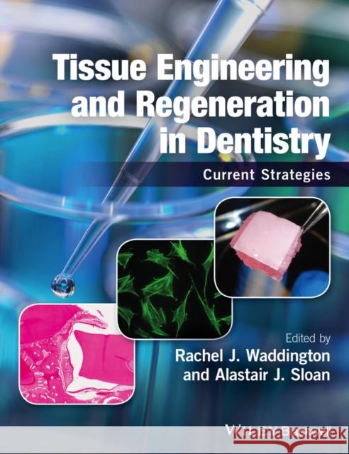 Tissue Engineering and Regeneration in Dentistry: Current Strategies Waddington, Rachel J. 9781118741108 Wiley-Blackwell