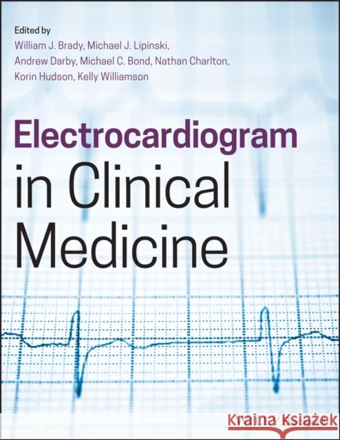 Electrocardiogram in Clinical Medicine William J. Brady 9781118754559 Wiley-Blackwell