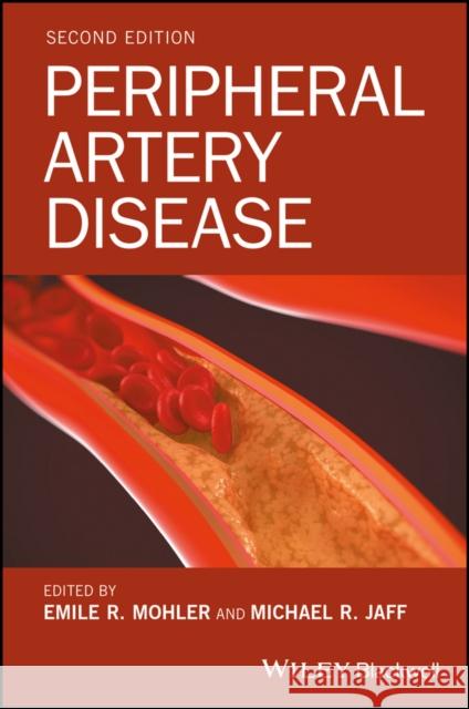 Peripheral Artery Disease Emile R. Mohler Michael R. Jaff 9781118776094
