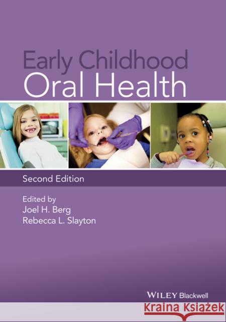 Early Childhood Oral Health Berg, Joel H.; Slayton, Rebecca L. 9781118792100