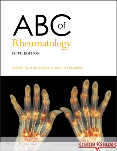 ABC of Rheumatology  9781118793213 John Wiley & Sons Inc