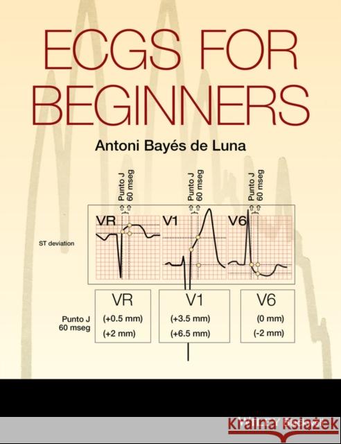 Ecgs for Beginners Bayés de Luna, Antoni 9781118821312 John Wiley & Sons