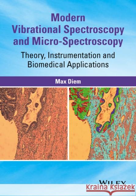 Modern Vibrational Spectroscopy and Micro-Spectroscopy: Theory, Instrumentation and Biomedical Applications Diem, Max 9781118824863 John Wiley & Sons