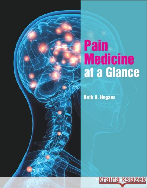 Pain Medicine at a Glance Beth B. Hogans 9781118837665 Wiley-Blackwell
