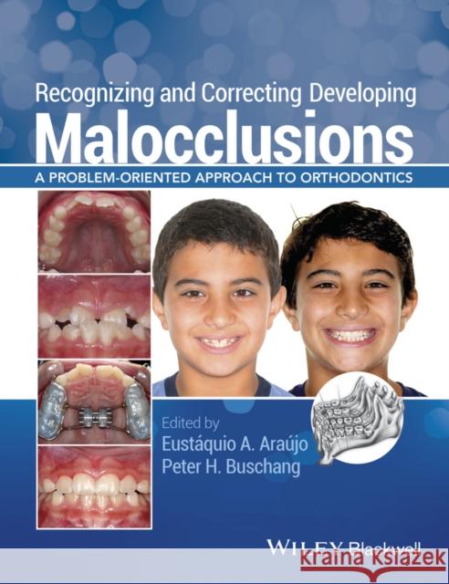 Recognizing and Correcting Developing Malocclusions : A Problem-Oriented Approach to Orthodontics  9781118886120 John Wiley & Sons