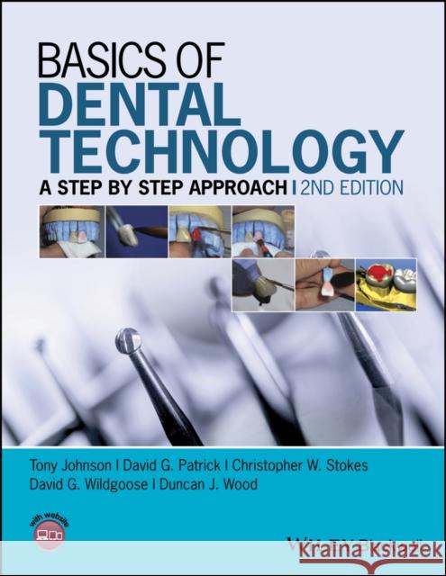 Basics of Dental Technology: A Step by Step Approach Johnson, Tony 9781118886212