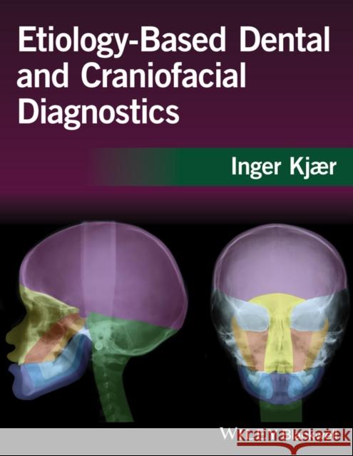 Etiology-Based Dental and Craniofacial Diagnostics Kjaer, Inger 9781118912126 John Wiley & Sons