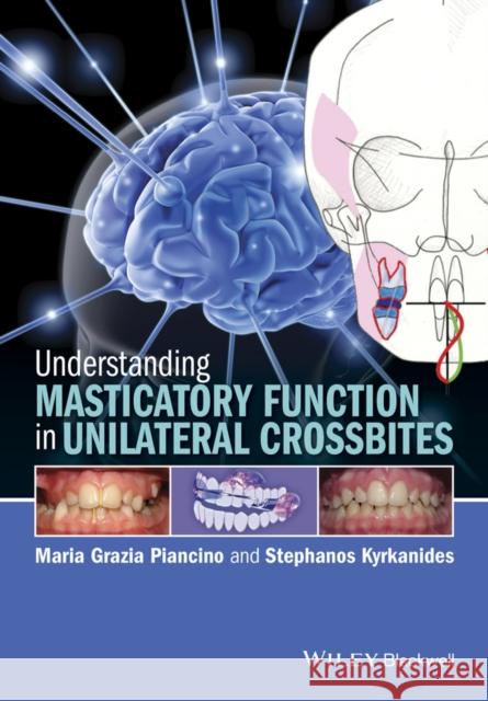 Understanding Masticatory Function in Unilateral Crossbites Piancino, Maria G.; Kyrkanides, Stephanos 9781118971871 John Wiley & Sons