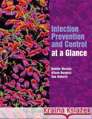 Infection Prevention and Control at a Glance Debbie Weston Alison Burgess Sue Roberts 9781118973554