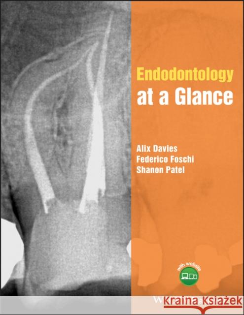 Endodontology at a Glance Alix Davies Federico Foschi Shanon Patel 9781118994702 Wiley-Blackwell