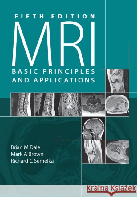 MRI: Basic Principles and Applications Dale, Brian M. 9781119013051 John Wiley & Sons