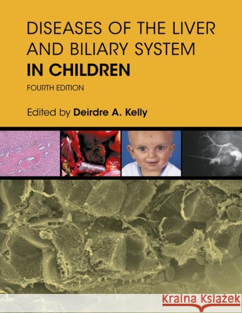 Diseases of the Liver and Biliary System in Children Kelly, Deirdre 9781119046905