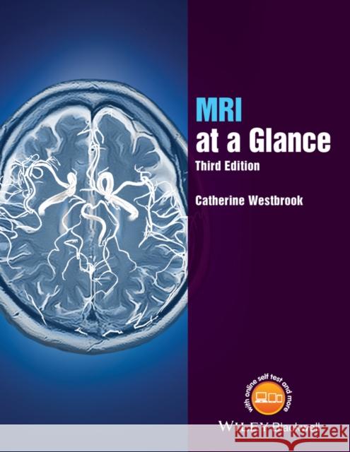 MRI at a Glance Westbrook, Catherine 9781119053552