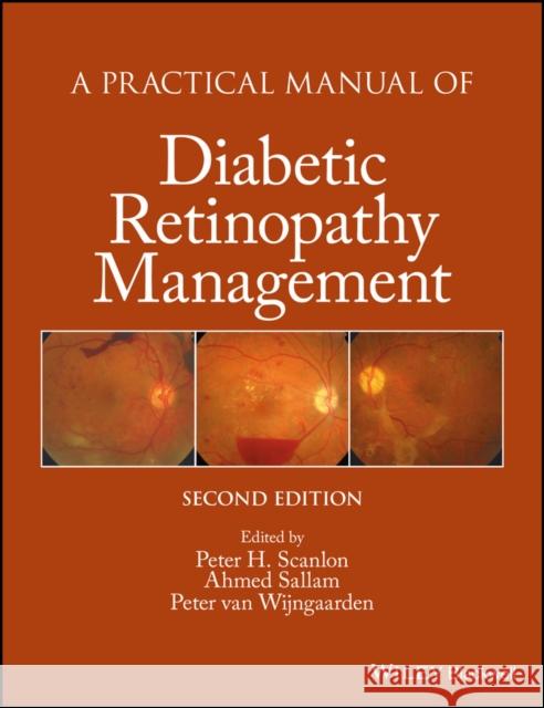 A Practical Manual of Diabetic Retinopathy Management Scanlon, Peter; Sallam, Ahmed 9781119058953
