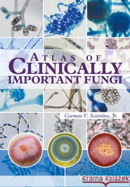 Atlas of Clinically Important Fungi Sciortino, Carmen 9781119069669 John Wiley & Sons