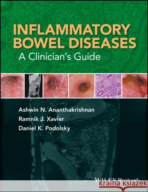 Inflammatory Bowel Diseases: A Clinician's Guide Ananthakrishnan, Ashwin N. 9781119077602 John Wiley & Sons