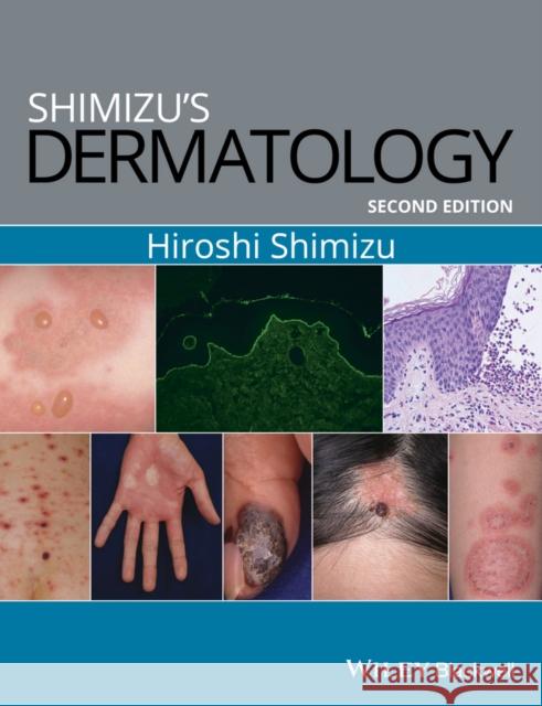 Shimizu's Dermatology Shimizu, Hiroshi 9781119099055