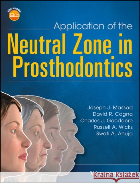 Application of the Neutral Zone in Prosthodontics Massad, Joseph J.; Cagna, David R.; Goodacre, Charles J. 9781119158141