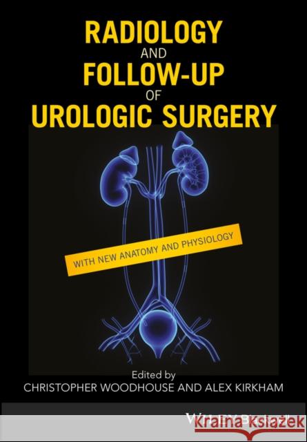 Radiology and Follow-Up of Urologic Surgery Christopher R. J. Woodhouse Alex Kirkham 9781119162087 Wiley-Blackwell