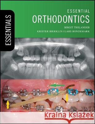 Essential Orthodontics Birgit Thilander Krister Bjerklin Lars Bondemark 9781119165675 Wiley-Blackwell
