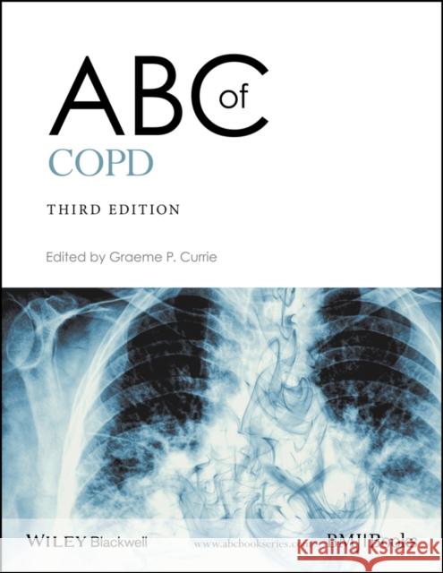 ABC of Copd Currie, Graeme P. 9781119212850