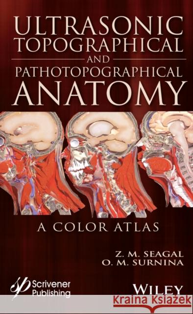 Ultrasonic Topographical and Pathotopographical Anatomy: A Color Atlas Julia V. Karakeyan 9781119223573 Wiley-Scrivener