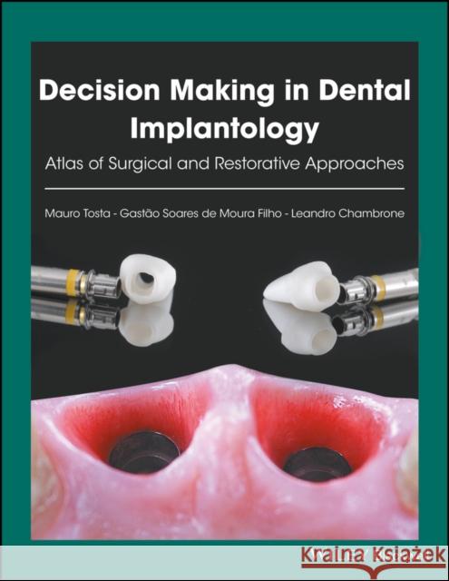 Decision Making in Dental Implantology : Atlas of Surgical and Restorative Approaches Tosta, Mauro; de Moura Filho, Gastão Soares; Chambrone, Leandro 9781119225942 