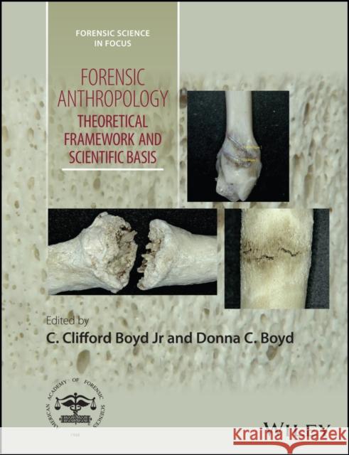 Forensic Anthropology: Theoretical Framework and Scientific Basis Boyd, Donna C. 9781119226383 Wiley