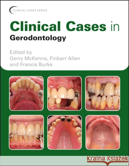 Clinical Cases in Gerodontology McKenna, Gerry 9781119226598 