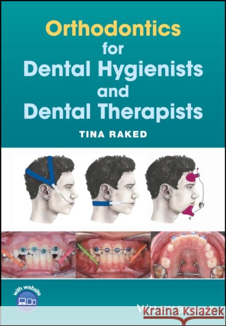 Orthodontics for Dental Hygienists and Dental Therapists Tina Raked 9781119251880 Wiley-Blackwell