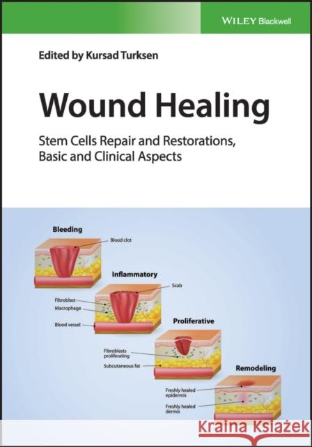 Wound Healing: Stem Cells Repair and Restorations, Basic and Clinical Aspects Kursad Turksen 9781119282488 Wiley-Blackwell