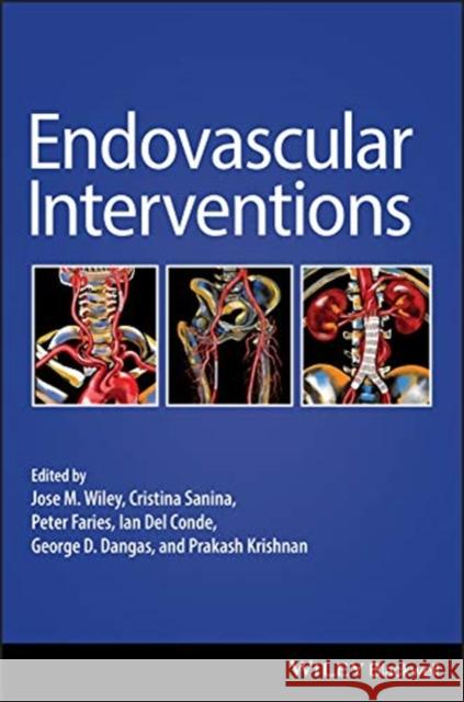Endovascular Interventions Jose M. Wiley Cristina Sanina Peter Faries 9781119283492