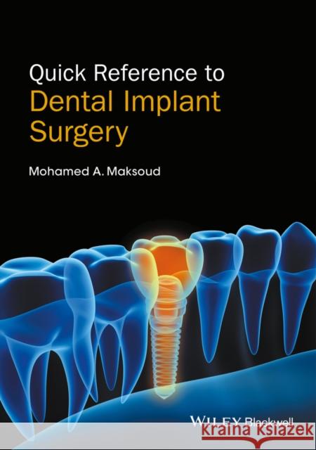 Quick Reference to Dental Implant Surgery Maksoud, Mohamed A. 9781119290124