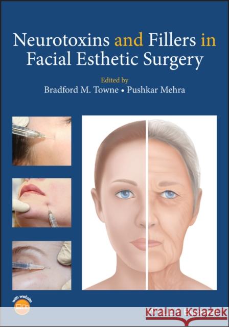 Neurotoxins and Fillers in Facial Esthetic Surgery Bradford M. Towne Pushkar Mehra 9781119294276 Wiley-Blackwell