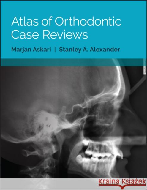 Atlas of Orthodontic Case Reviews Askari, Marjan; Alexander, Stanley A. 9781119303756 John Wiley & Sons