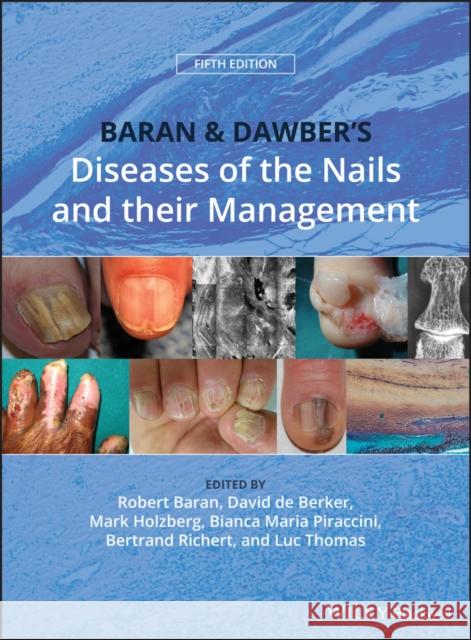 Baran and Dawber's Diseases of the Nails and Their Management Baran, Robert 9781119323358