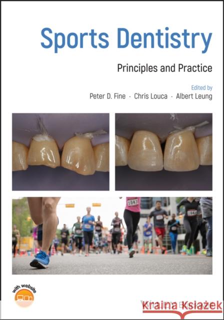 Sports Dentistry: Principles and Practice Fine, Peter D. 9781119332558