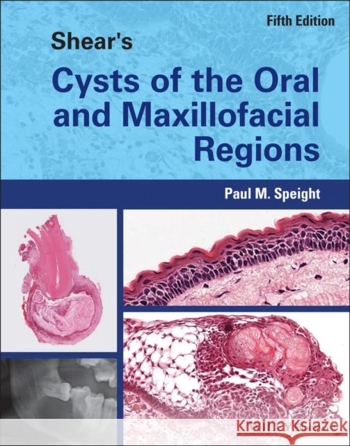 Shear's Cysts of the Oral and Maxillofacial Regions Paul Speight   9781119354994 Wiley-Blackwell (an imprint of John Wiley & S