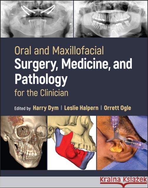 Oral and Maxillofacial Surgery, Medicine, and Pathology for the Clinician Harry Dym Leslie Halpern Orrett Ogle 9781119361497 Wiley-Blackwell