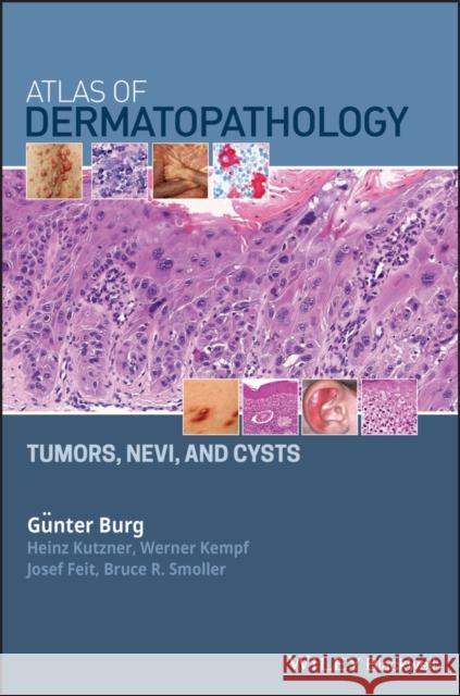 Atlas of Dermatopathology: Tumors, Nevi, and Cysts Burg, Günter 9781119371540