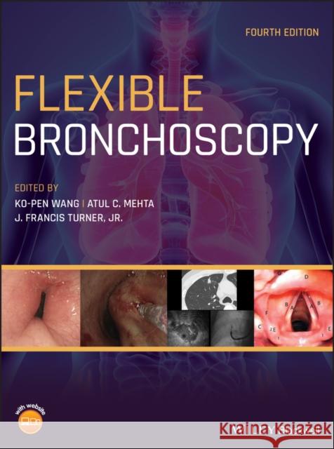 Flexible Bronchoscopy Ko-Pen Wang Atul C. Mehta J. Francis Turner 9781119389057