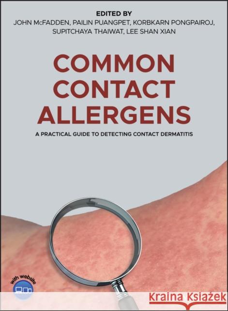 Common Contact Allergens: A Practical Guide to Detecting Contact Dermatitis McFadden, John 9781119405665