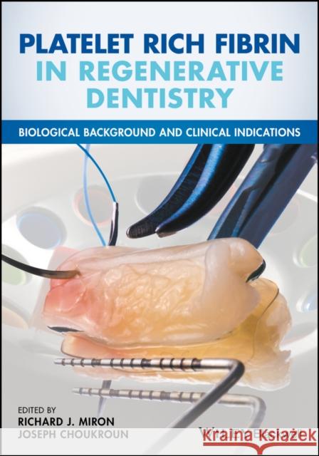 Platelet Rich Fibrin in Regenerative Dentistry: Biological Background and Clinical Indications Miron, Richard 9781119406815 John Wiley & Sons